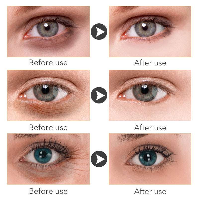Anti - Ageing Women's Eye Cream - Exactly Bliss
