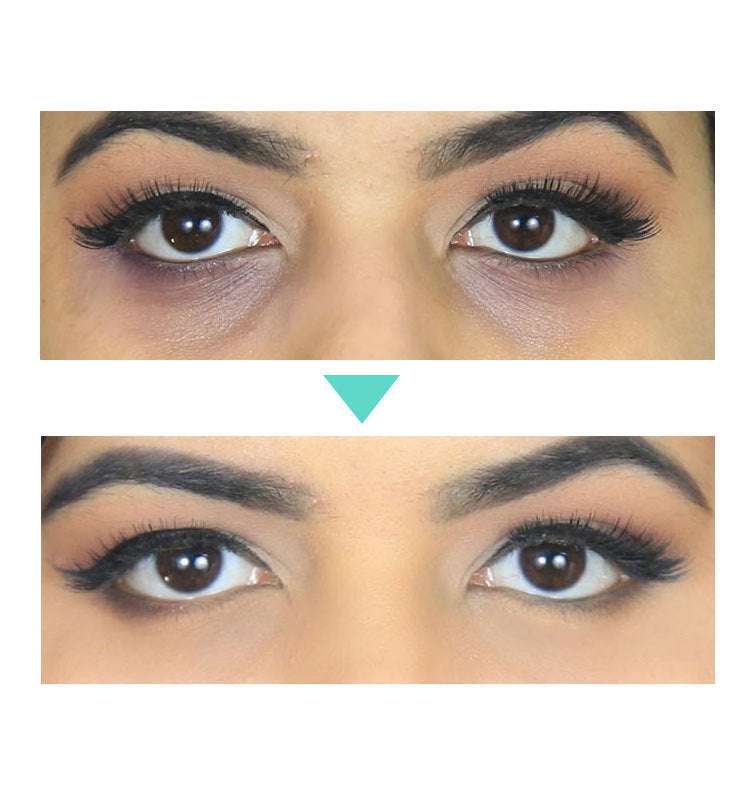 Anti - Ageing Women&